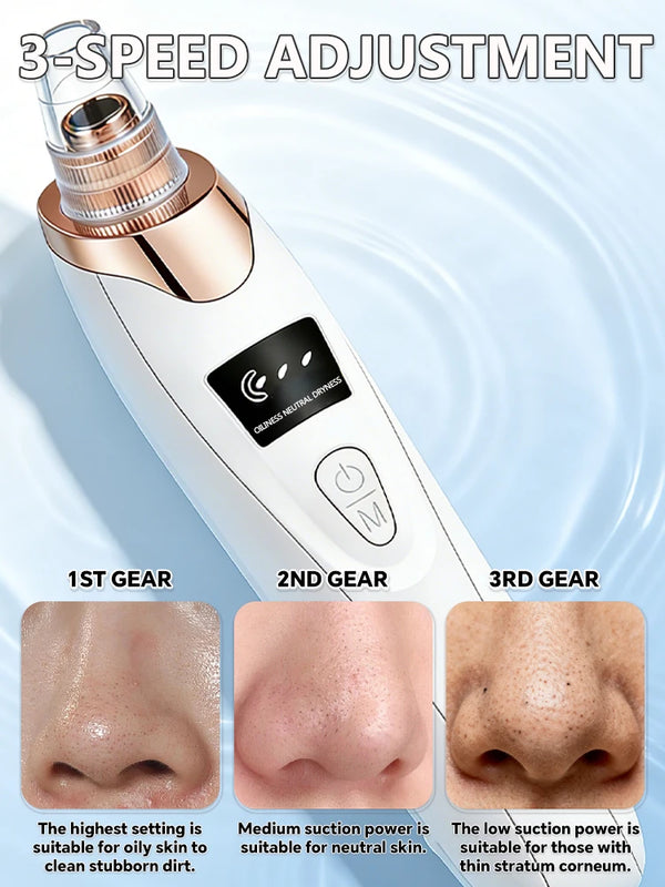 Generation-2-Removes-impurities-from-the-surface-of-the-nose-with-high-tech-vacuum-suction-say.jpg