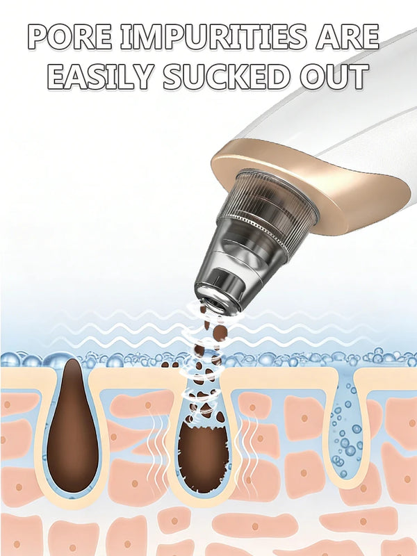 Generation-2-Removes-impurities-from-the-surface-of-the-nose-with-high-tech-vacuum-suction-say.jpg